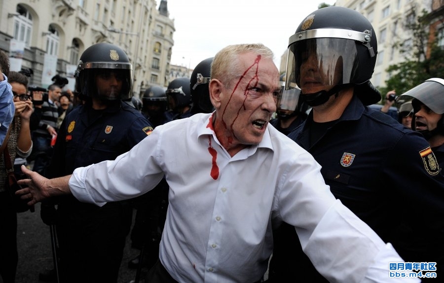a-man-with-a-head-wound-tries-to-calm-the-crowd-of-protestors-during-a-demonstration-surrounding-the-spanish-parliament-to-protest-against-spending-cuts-and-the-government-of-mariano-rajoy.jpg